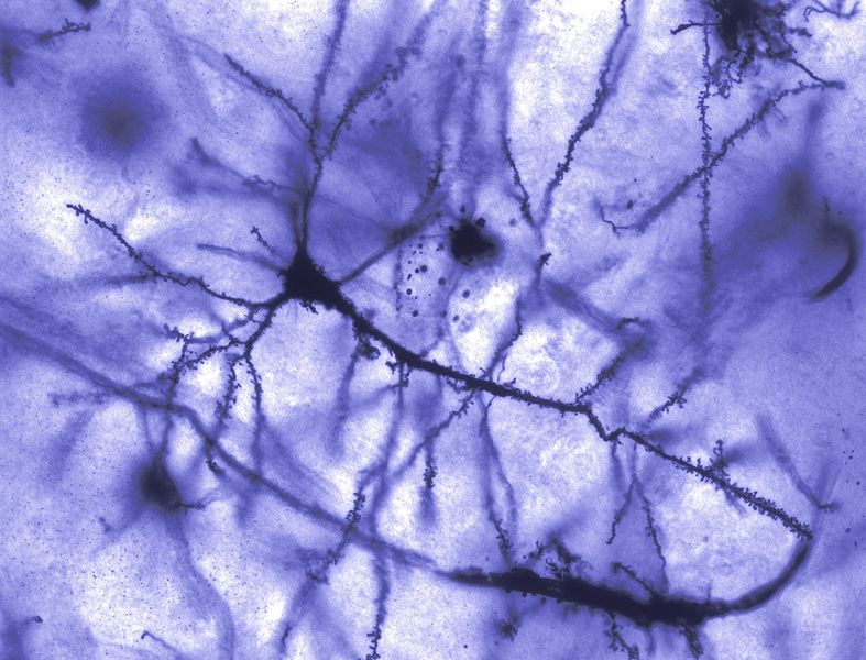 Tiedosto:Hermosolu (sininen).jpg